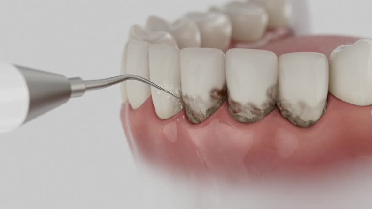 Reliable Dental contractor in New Haven, IN by Dentist Open Now